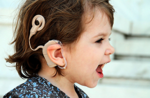 Cochlear Implants