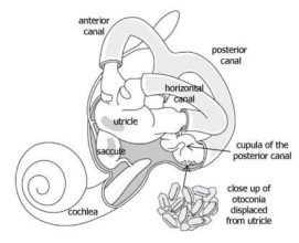 BPPV Treatment