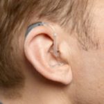 best bte hearing aid