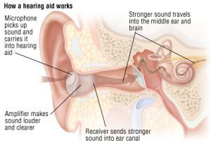 conductive hearing loss treatment