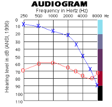 high frequency audiogram