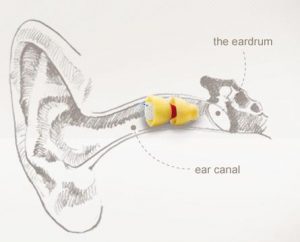 inserting the lyric hearing aid