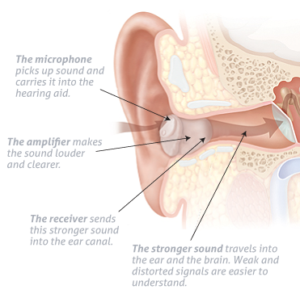 How Hearing Aids Work