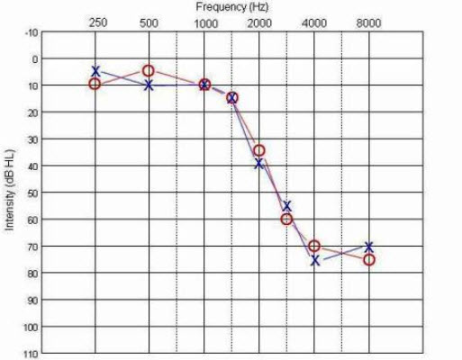 hearing frequency