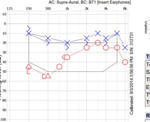 hearing test results