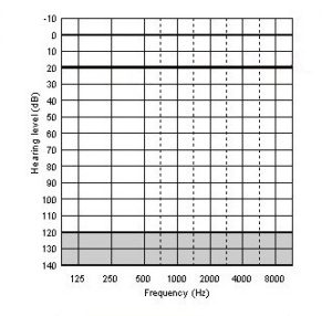 mølle kritiker Hilse How To Read Your Hearing Test Results – Hearing Choices